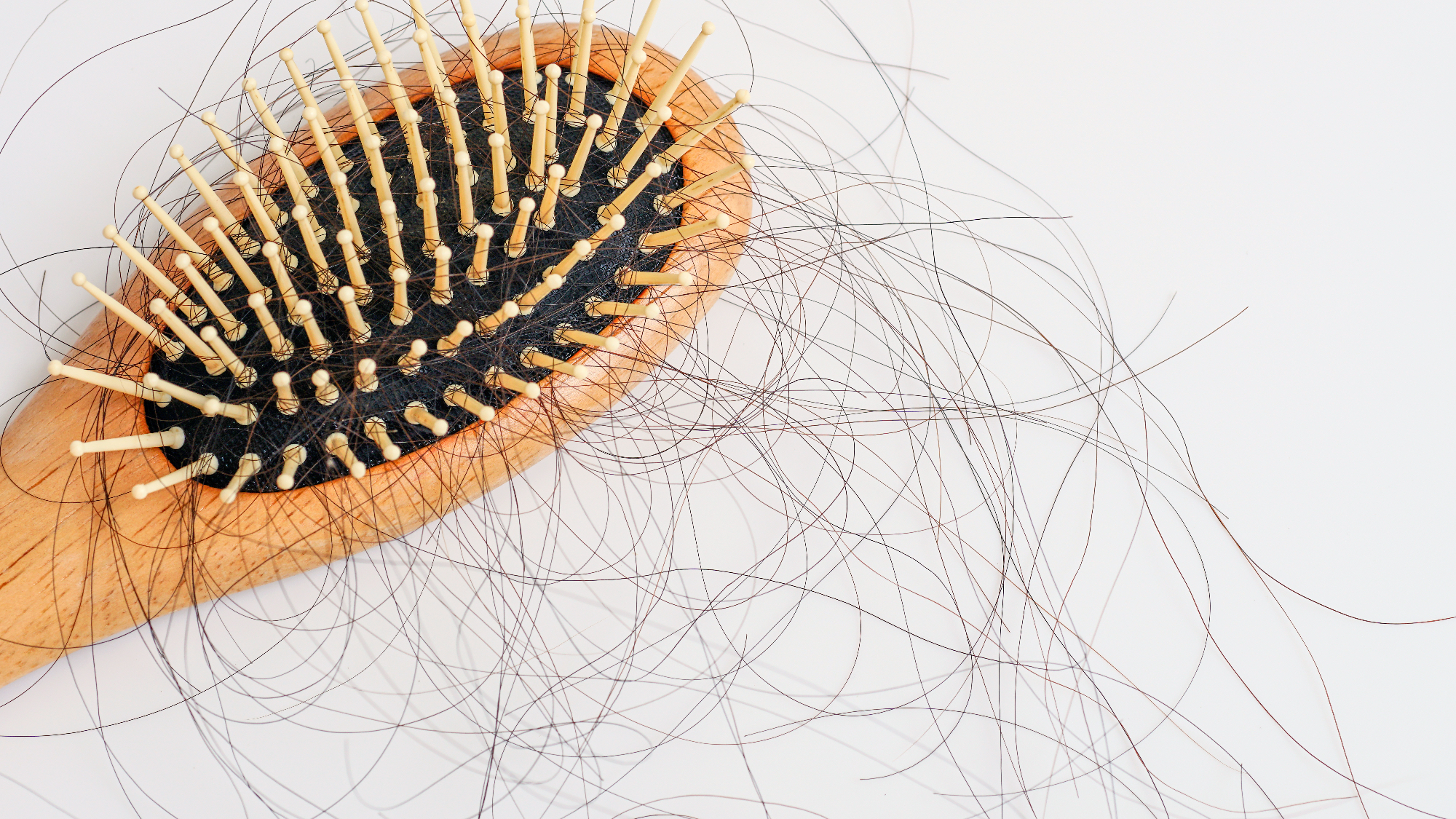 Kako preprečiti izpadanje las je zelo zahtevno vprašanje